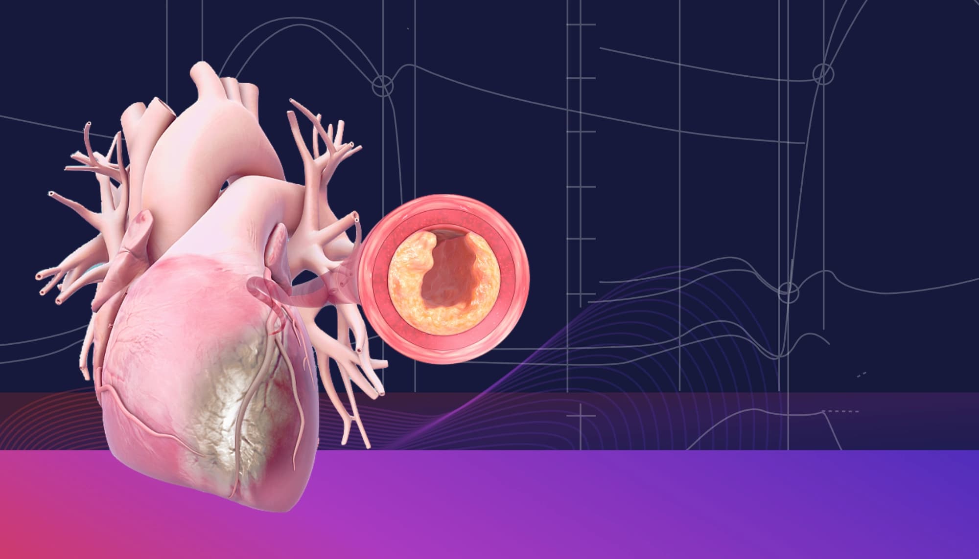 Illustration ur kursen Médecine cardiovasculaire