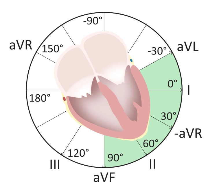 Système de référence hexaxial montrant les angles des dérivations