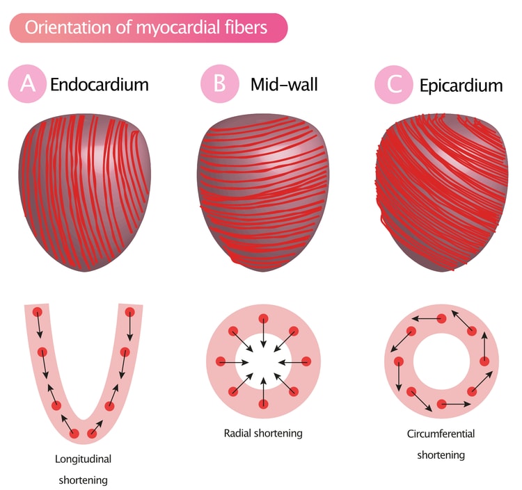 Figure 2A-2C. Orientation of myocardial muscle fibers result in longitudinal, radial and circumferential shortening (contraction).