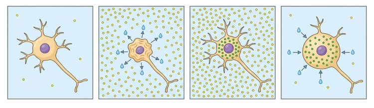 Quatre cases montrant la même cellule nerveuse : taille normale, cellule rétractée qui perd de l'eau dans un milieu riche en sodium, volume cellulaire restauré grâce aux osmoles intracellulaires et cellule gonflée qui absorbe de l'eau après une baisse rapide de la natrémie.