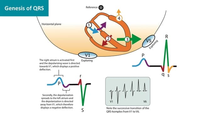 Illustration ur kursen L'ECG normal : de la normalité à la pathologie
