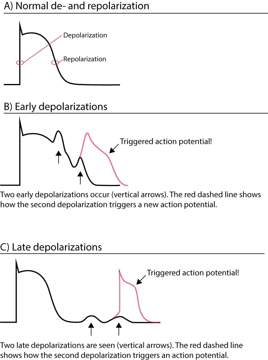 Figure 1. Post-dépolarisations tardives et précoces déclenchant des potentiels d'action.