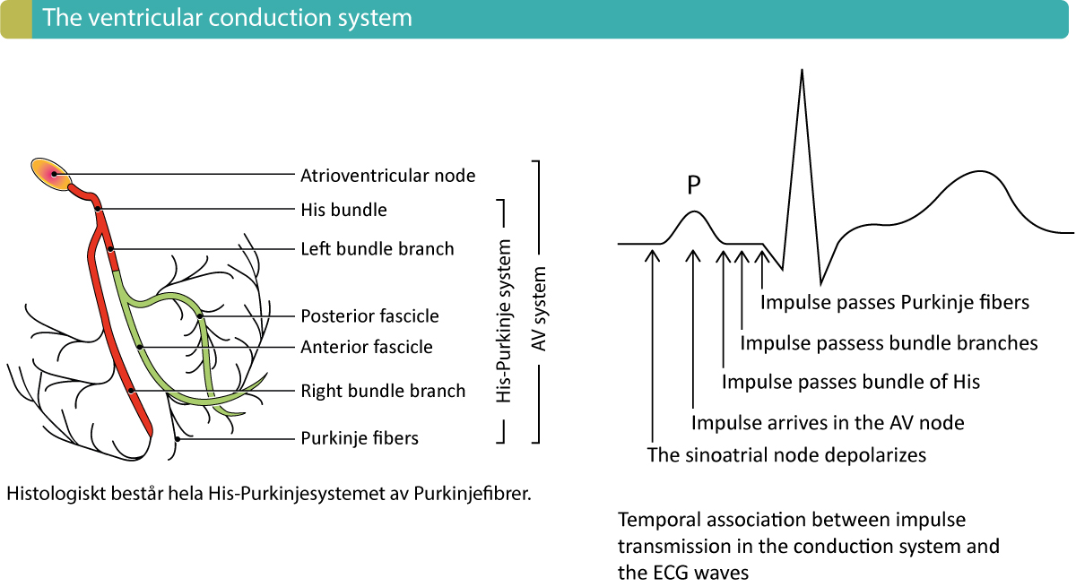 Figure 1. Composants du système de conduction ventriculaire et association temporelle entre l’ECG et la transmission de l’impulsion à travers le cœur. Un retard de conduction intraventriculaire peut survenir lorsque l’un des principaux composants du système de conduction est dysfonctionnel.