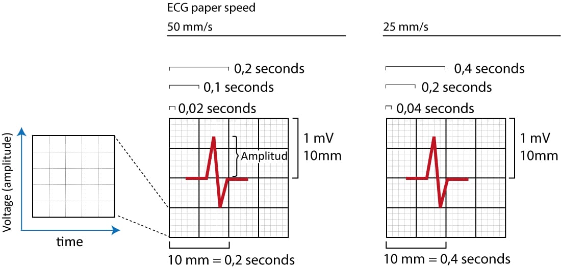 Figure 1. La grille ECG. L'axe des x représente le temps et l'axe des y l'amplitude des signaux électriques générés dans le myocarde. La même grille ECG est utilisée chez les enfants et les adultes.