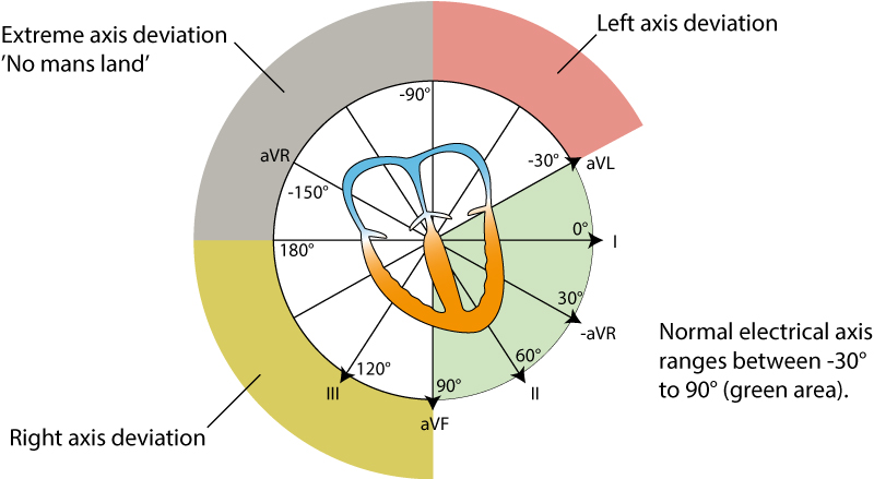 Figure 38. L'axe électrique du cœur (axe cardiaque).