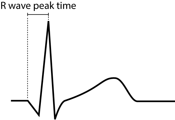 Figure 9. Le temps de culmination de l'onde R est défini comme l'intervalle de temps entre l'apparition du complexe QRS et l'apex de l'onde R
