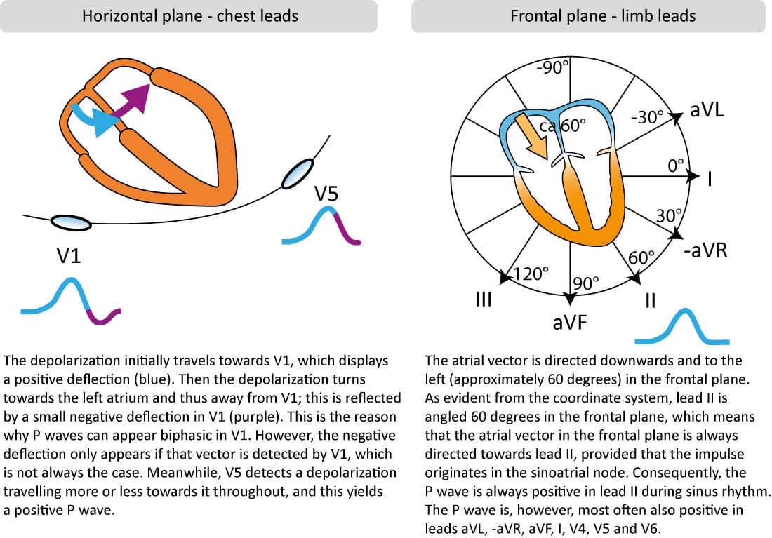 Figure 2. Morphologie de l'onde P dans les dérivations du thorax et des membres