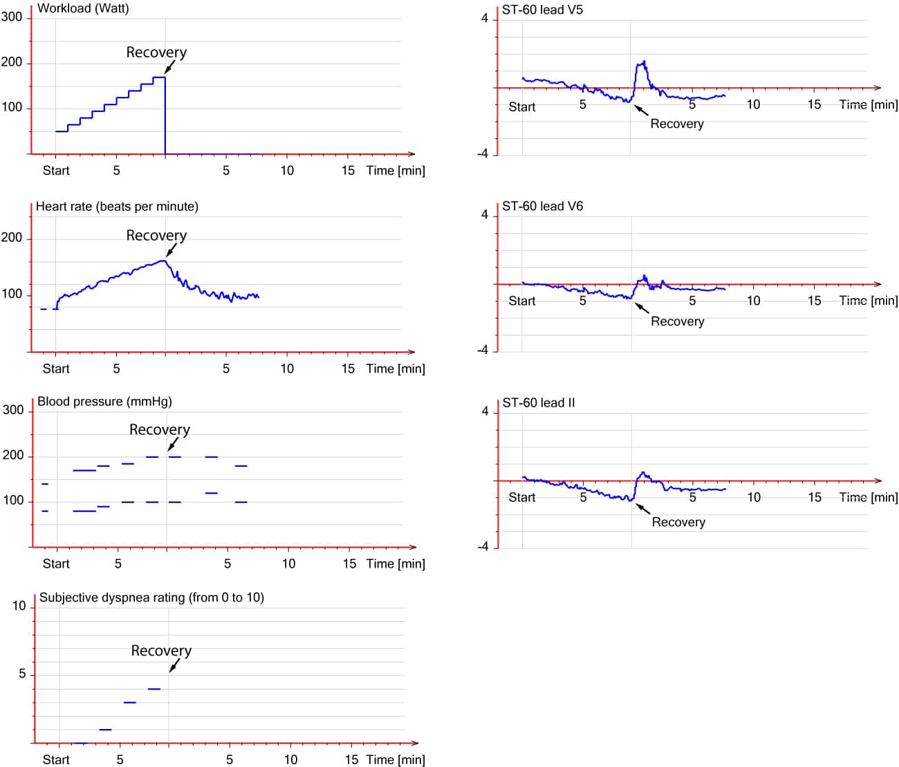Figure 6. Vue d'ensemble des résultats du test. Homme de 58 ans souffrant d'une maladie du tronc commun.