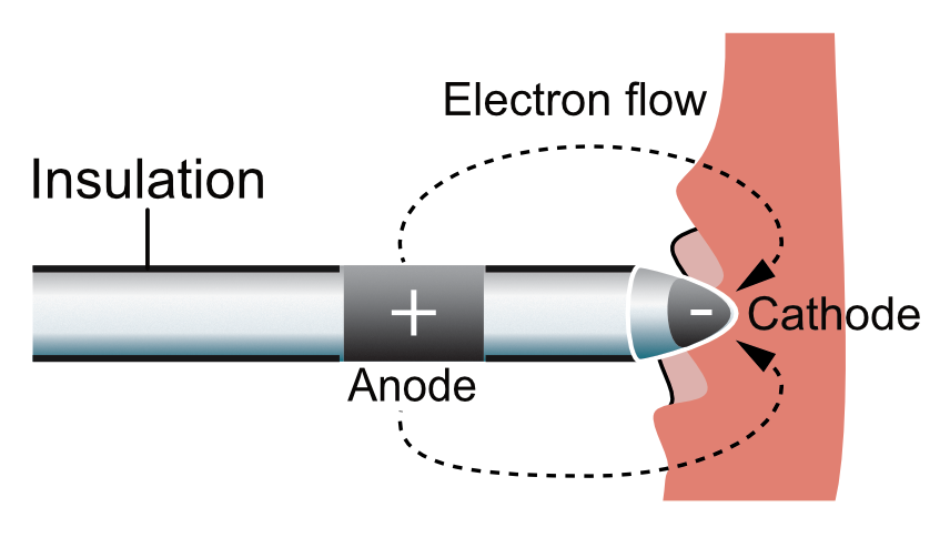 Figure 2. Sonde de stimulateur cardiaque.