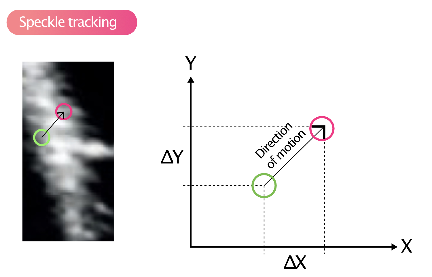 Figure 8. Suivi du speckle.