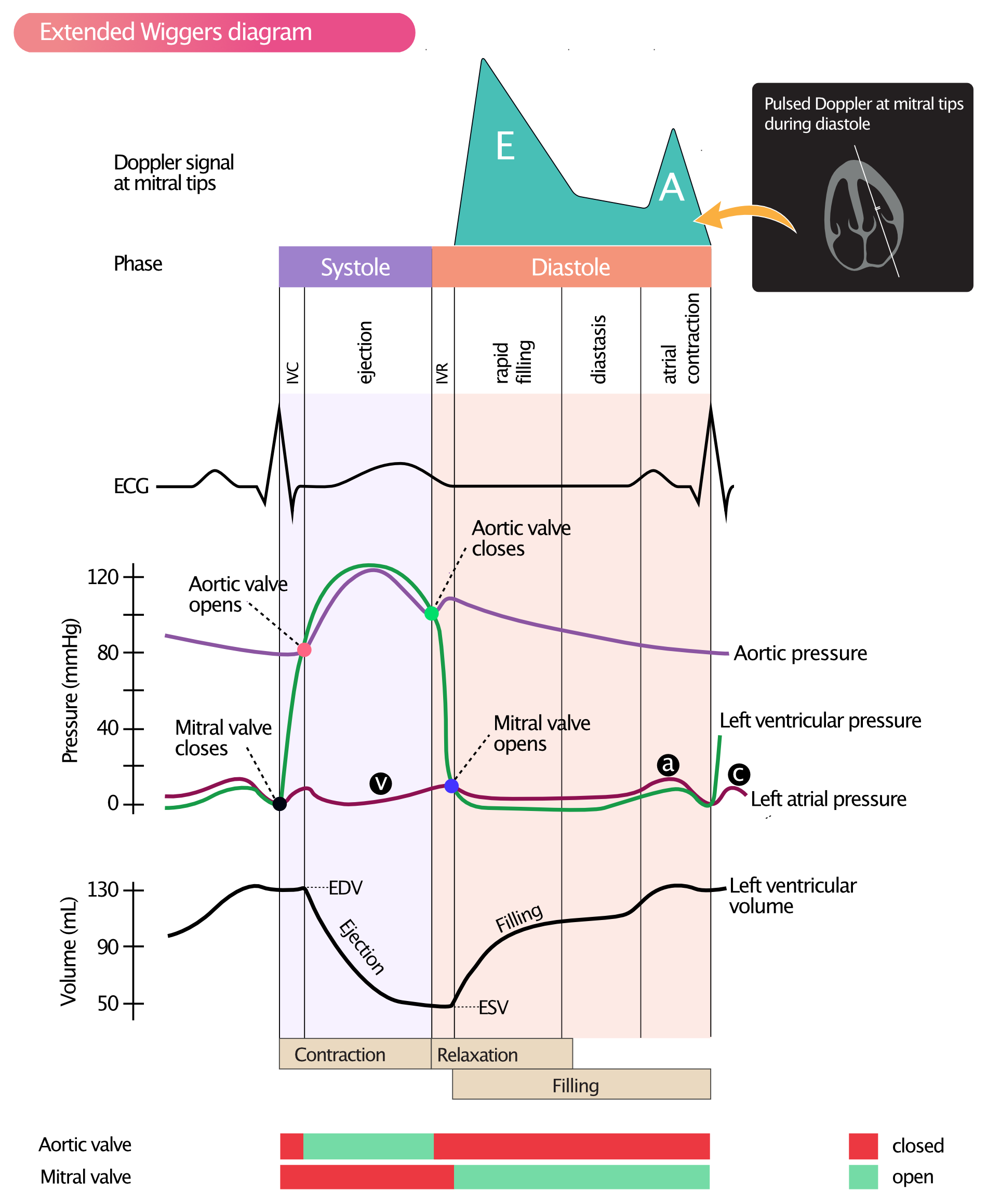 Figure 2. Diagramme de Wiggers montrant la pression, le volume, le signal Doppler, l'ECG et les valves AV pendant le cycle cardiaque. Enregistrement Doppler du débit de la valve mitrale pendant la diastole. (a) = remplissage auriculaire actif ; (b) = augmentation de la pression auriculaire due au gonflement de la valve mitrale dans l'oreillette gauche, lorsque la valve se ferme ; (c) = remplissage auriculaire passif.