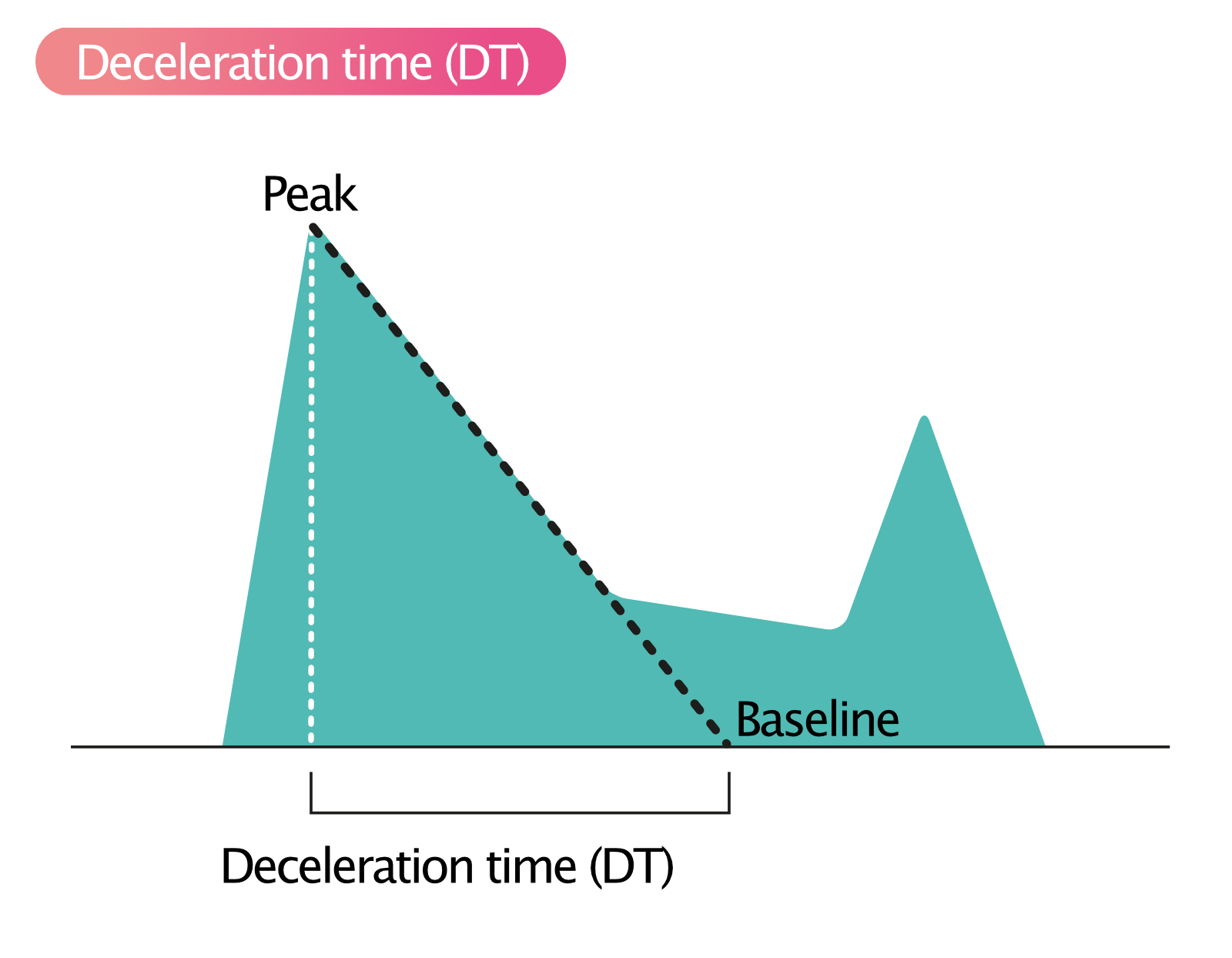 Figure 2. Temps de décélération (DT).