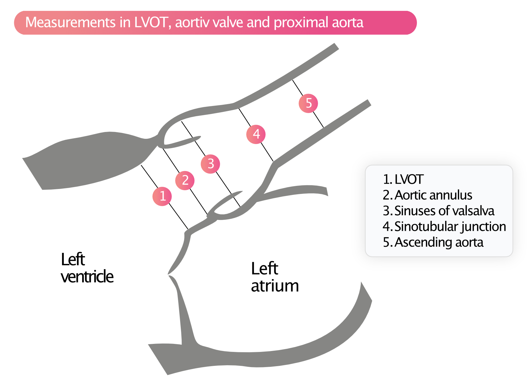 Figure 5. Mesures dans le LVOT, la valve aortique et l'aorte proximale.