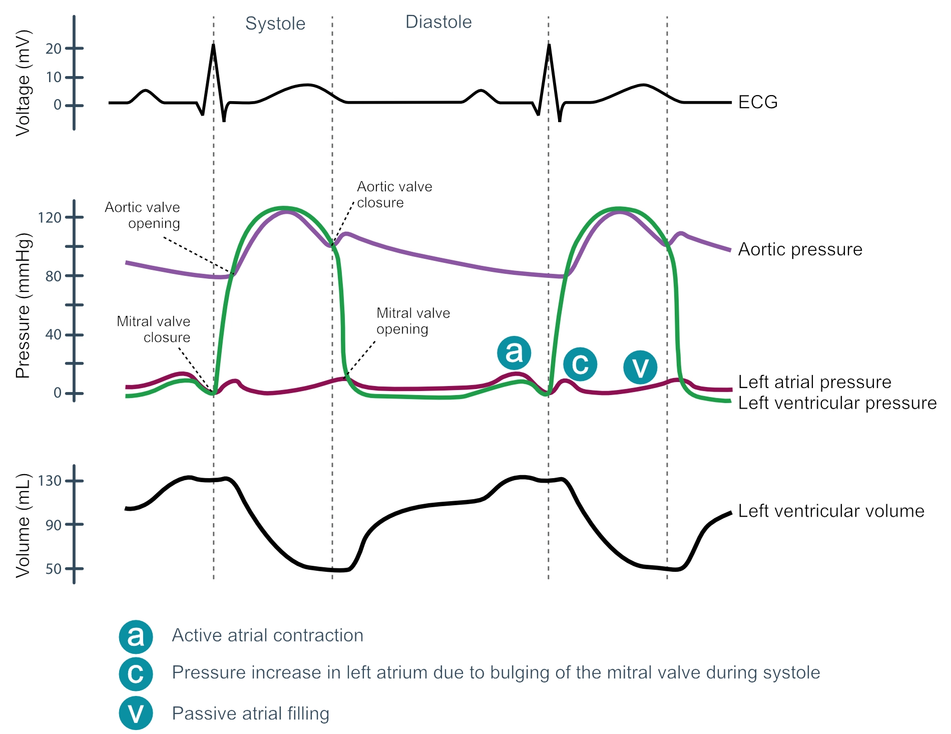 Figure 6. Le diagramme de Wiggers constitue un schéma de référence en physiologie cardiaque, représentant de manière synchronisée l’évolution de la pression aortique, de la pression ventriculaire et de la pression atriale, ainsi que les variations du volume ventriculaire et les tracés électrocardiographiques.