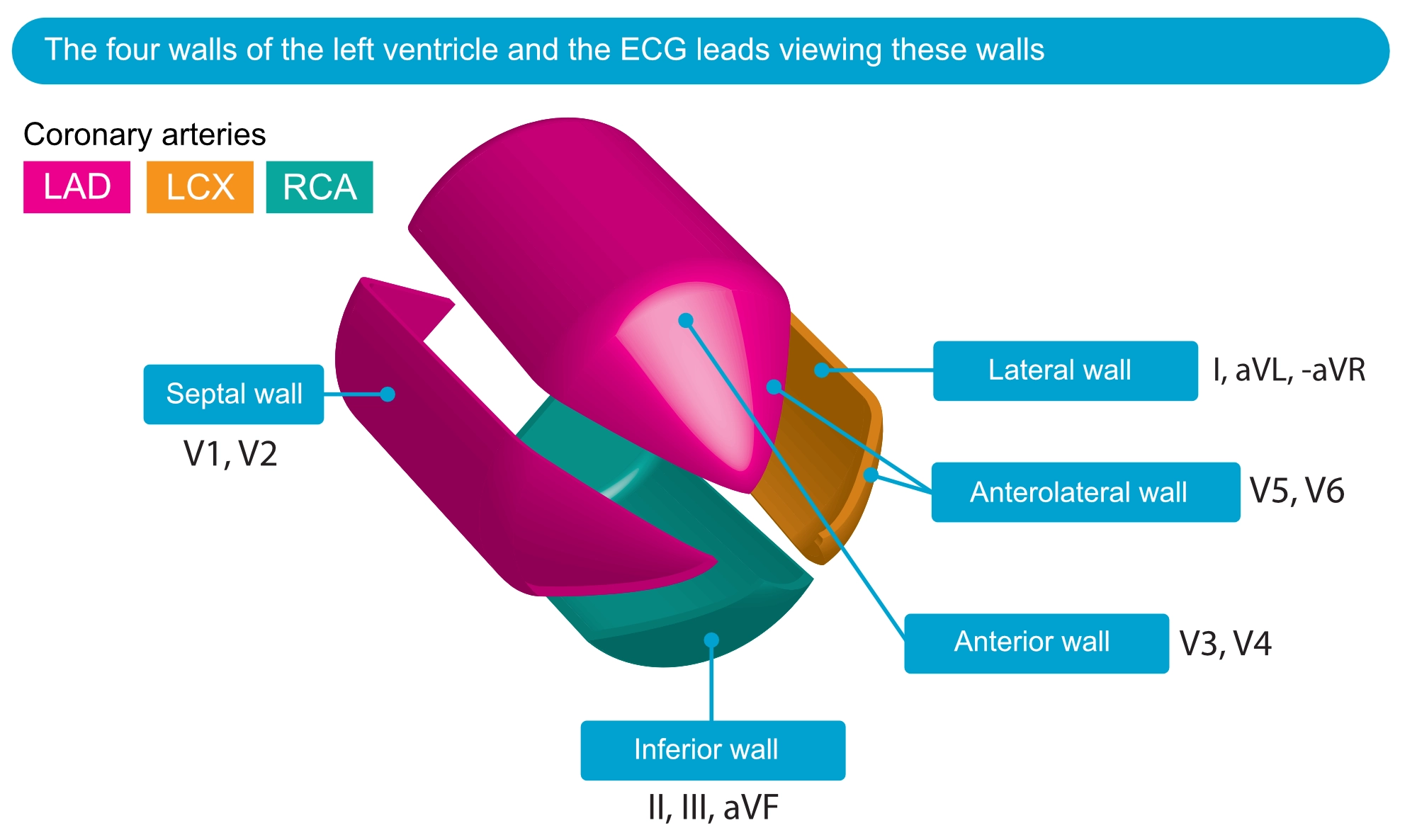 Figure 20. L’ECG à 12 dérivations enregistre principalement l’activité électrique du ventricule gauche.