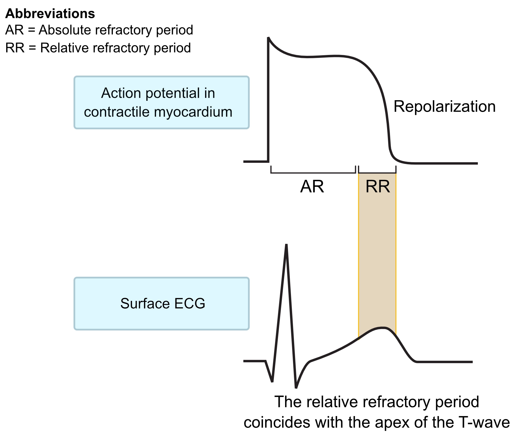 Figure 2. Périodes réfractaires absolues et relatives pendant le potentiel d’action.