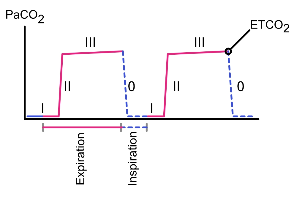 Capnogramme normal et phases respiratoires