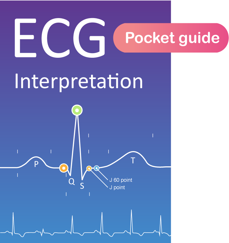 Guide De Poche ECG Laminé - Interprétation Rythme Cardiaque, Double Face, 8,9x15,2 Cm