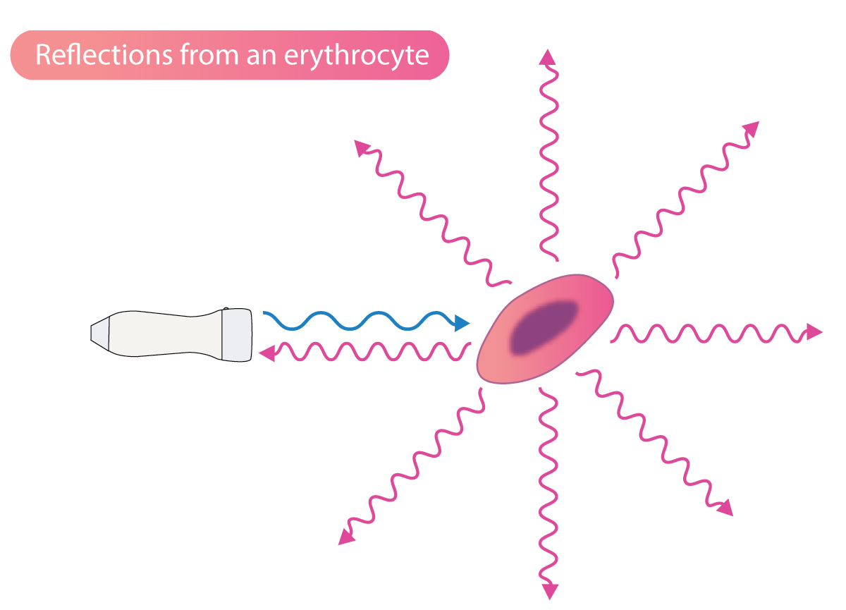 Effet Doppler et échocardiographie Doppler – Médecine Cardiovasculaire