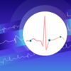 Interprétation de l'ECG clinique