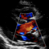 Echocardiographie clinique