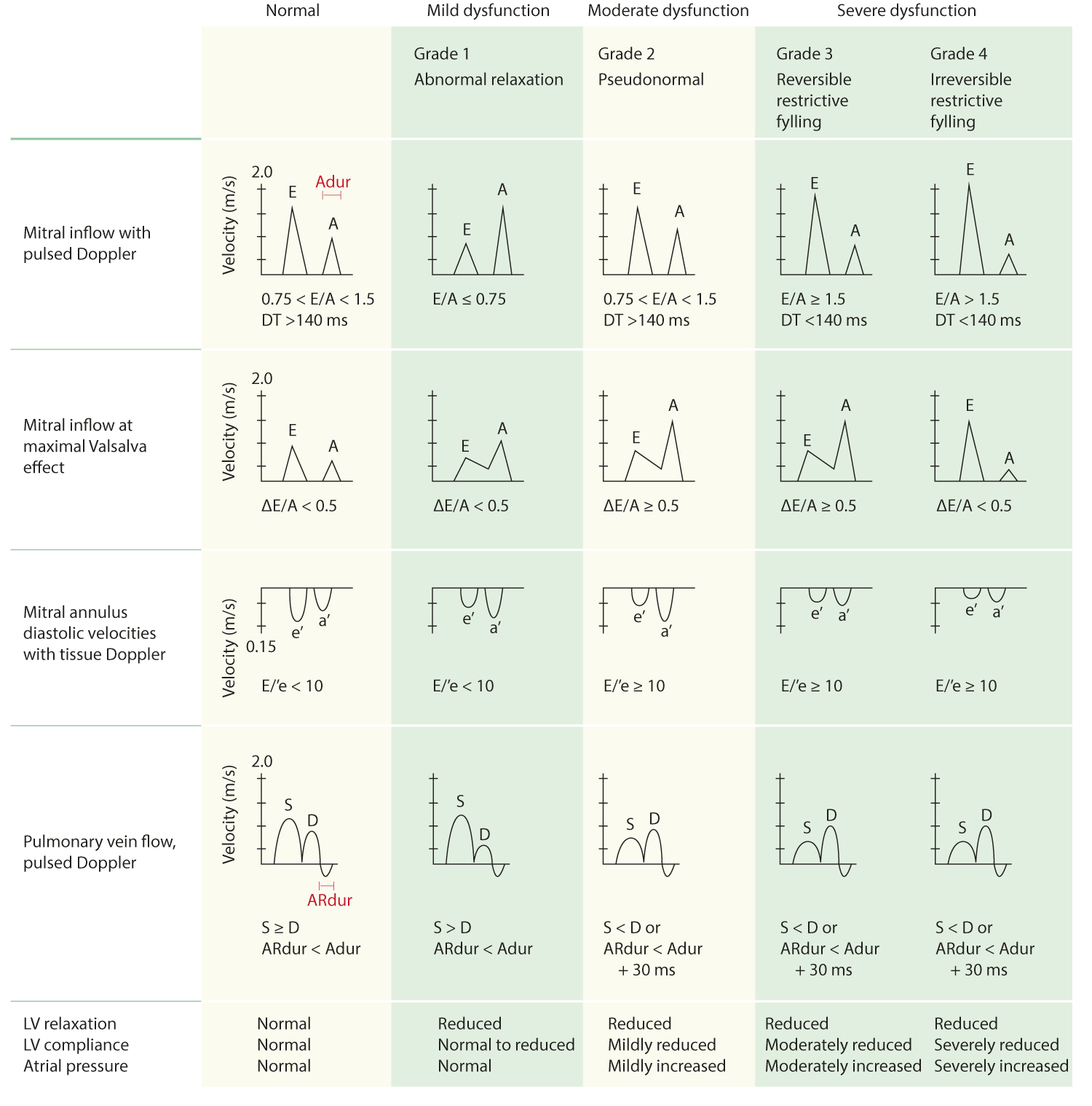 Left ventricular diastolic function – Médecine Cardiovasculaire