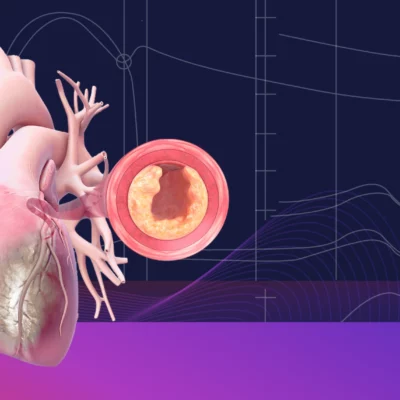 Cardiovascular Medicine